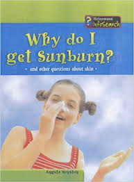 why do i get sunburn ?