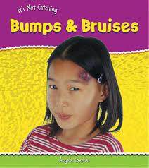 it's not catching: bumps and bruises