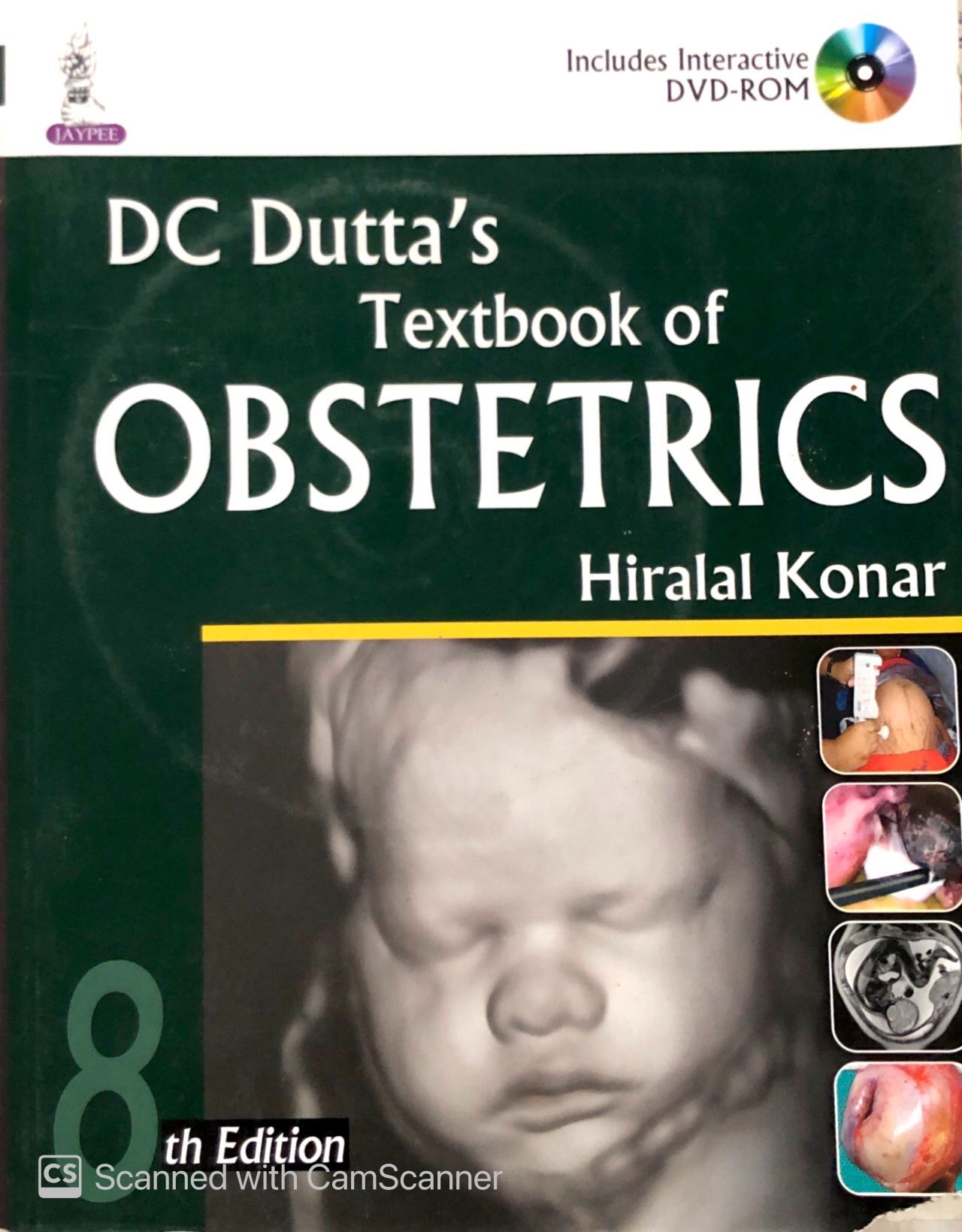 textbook of obstetrics (8th edition)