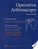 operative arthroscopy